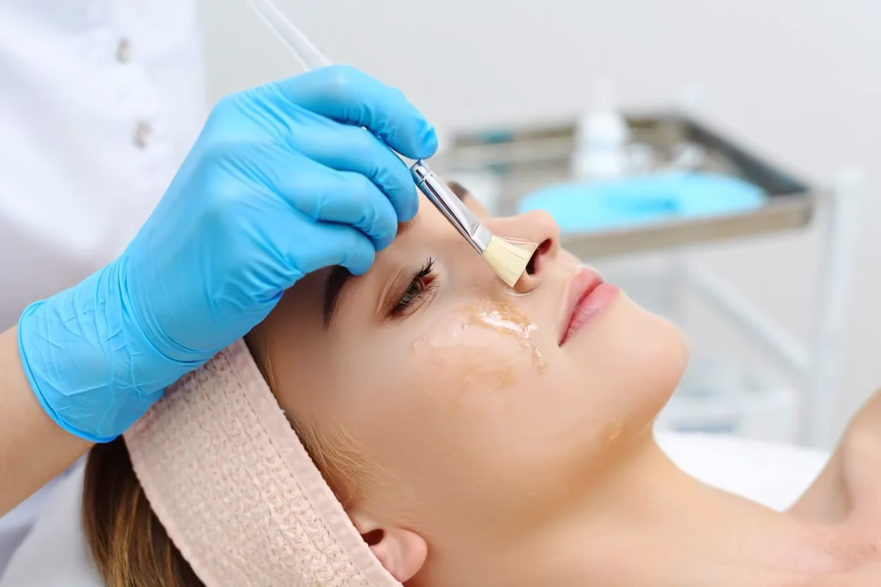 Update On Chemical Peels For 2025 a person applying a chemical peel on a woman's face